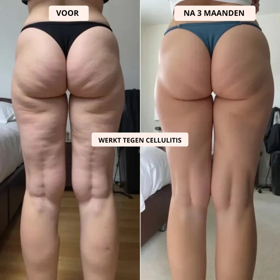 NOVA| Innovatieve 3D Anti-Cellulitis Legging