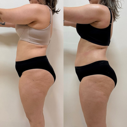 Flowziax Anti Cellulite Massage Olie